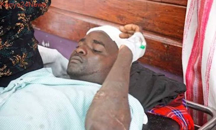 2_10-injured-in-nyali-kisauni-fresh-attacks_20191124205358_8_d.webp