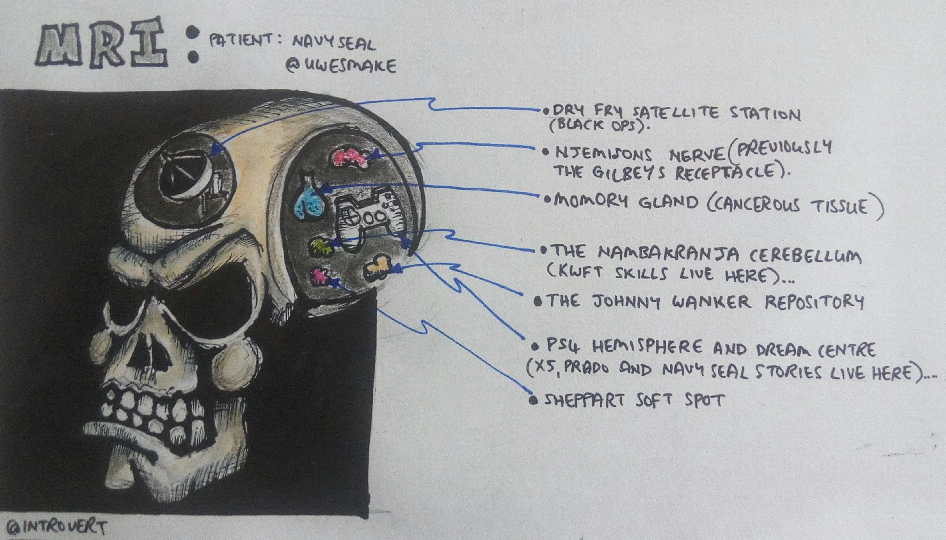 MRI Uwes.webp